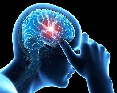 How Migraines Affect The Brain